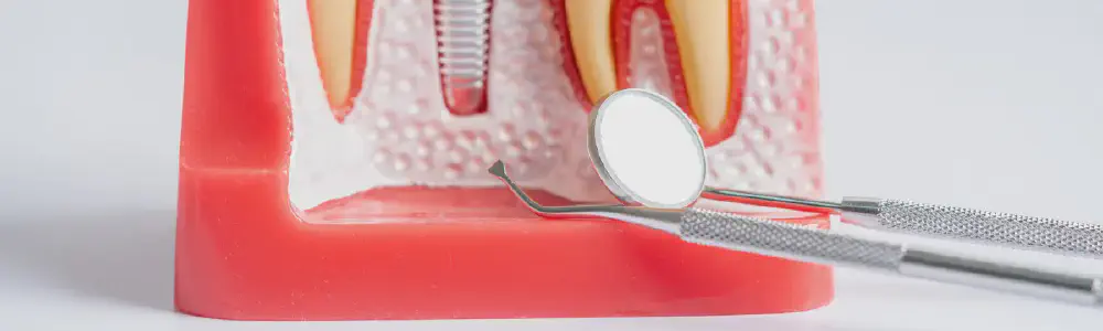 title.webp