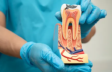 We offer Root Canal in Rancho Cucamonga